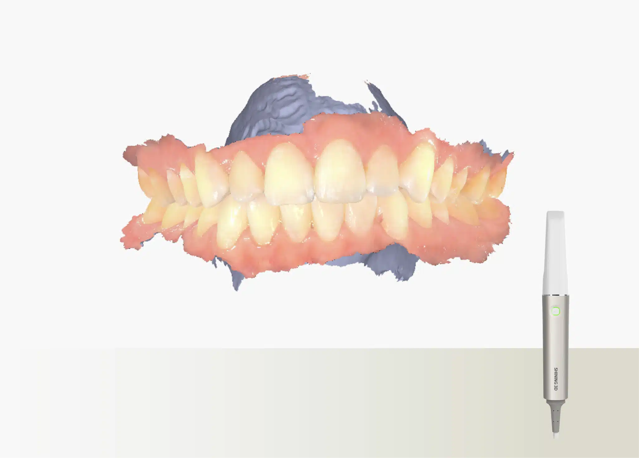 Aoralscan Shining Elite Wired - Image 3