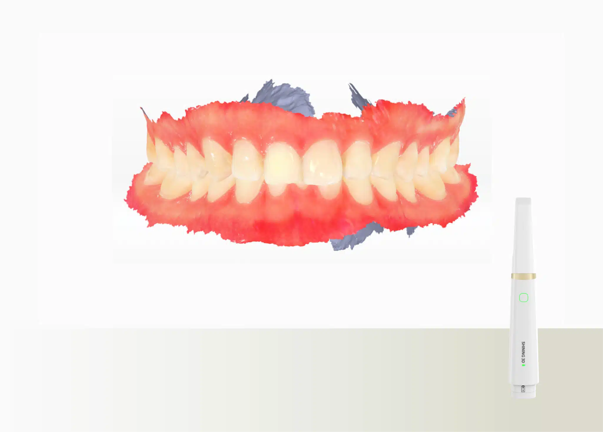 Aoralscan Shining Elite Wireless - Image 4